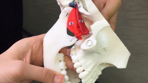 3D-печатный макет челюстного сустава Макет челюстного сустава